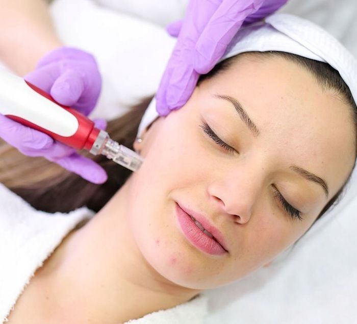 dermapen-mym-mezoterapia-mikroiglowa-serum-rodzaj-mezoterapii-mikroiglowa-jpeg.jpg
